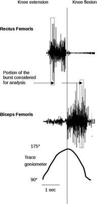 Not all Forms of Muscle Hypertonia Worsen With Fatigue: A Pilot Study in Para Swimmers